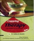 (image for) Cupping Therapy